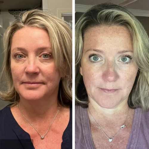 Clarivelle™ Base Floutante Précision Ridules